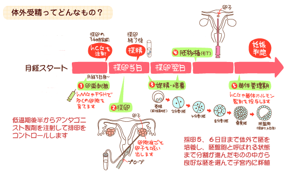 体外受精 Ivf 兵庫県神戸市の山下レディースクリニック